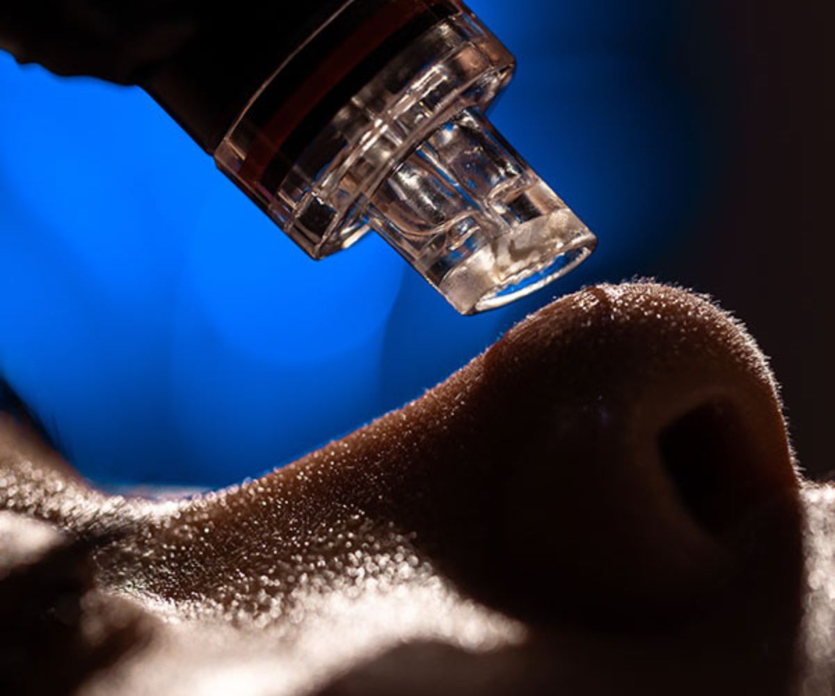 trattamento hydraskin torino